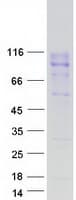 Human CEACAM20 Protein (Recombinant Myc-DDK (Flag))