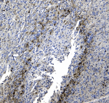 Polyclonal Rabbit anti-Human SYT1 / Synaptotagmin Antibody (IHC, WB)