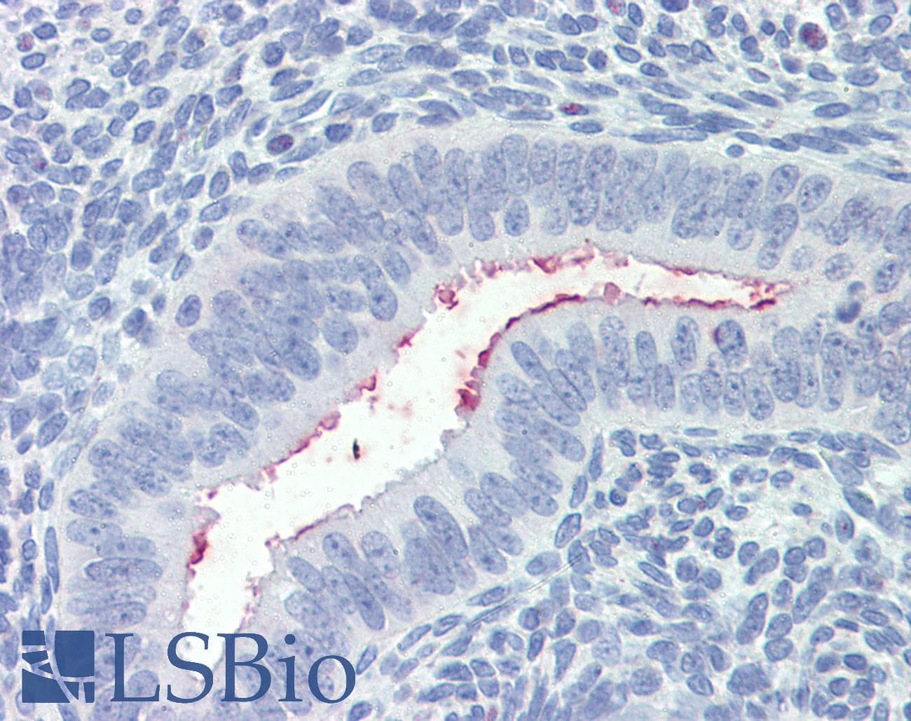 IHC-plus™ Polyclonal Goat anti-Human SFRP1 Antibody (aa302-314, IHC)