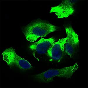 Monoclonal Mouse anti-Human ALCAM / CD166 Antibody (clone 8E12C7, aa48-216, IHC, IF, WB)