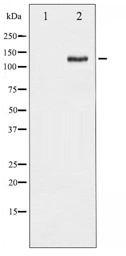 FAK / Focal Adhesion Kinase Antibody (phospho-Ser843)