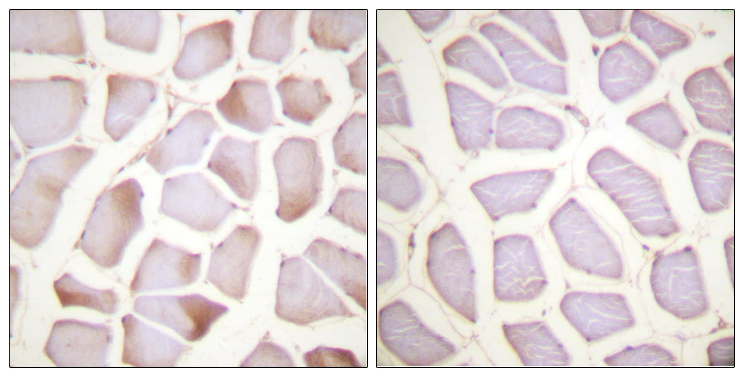 Polyclonal Rabbit anti-Mouse TNNI3 / Cardiac Troponin I Antibody (phospho-Ser22/Ser23, IHC, WB)
