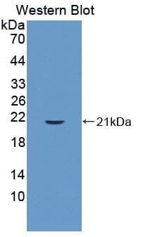 PPIB / Cyclophilin B Antibody (aa34-216, Biotin)