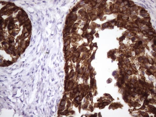 KRT16 / CK16 / Cytokeratin 16 Antibody (clone 7A4, Carrier-free)
