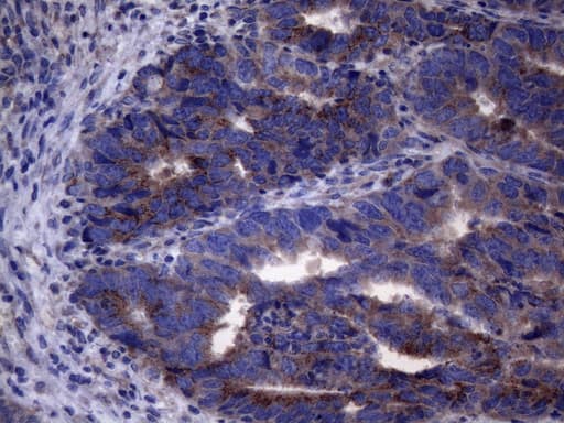AKIP1 / BCA3 Antibody (clone OTI2E4)