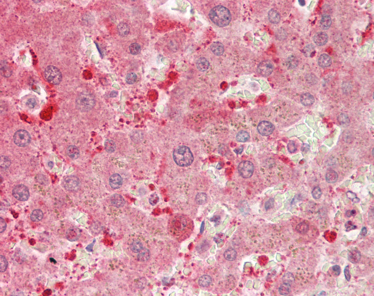 Polyclonal Rabbit anti-Human DDH / AKR1C1 Antibody (aa99-148, IHC, WB)