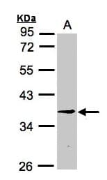RPF2 / BXDC1 Antibody (aa1-217)