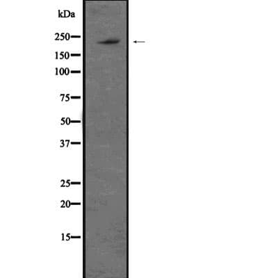DICER1 / Dicer Antibody