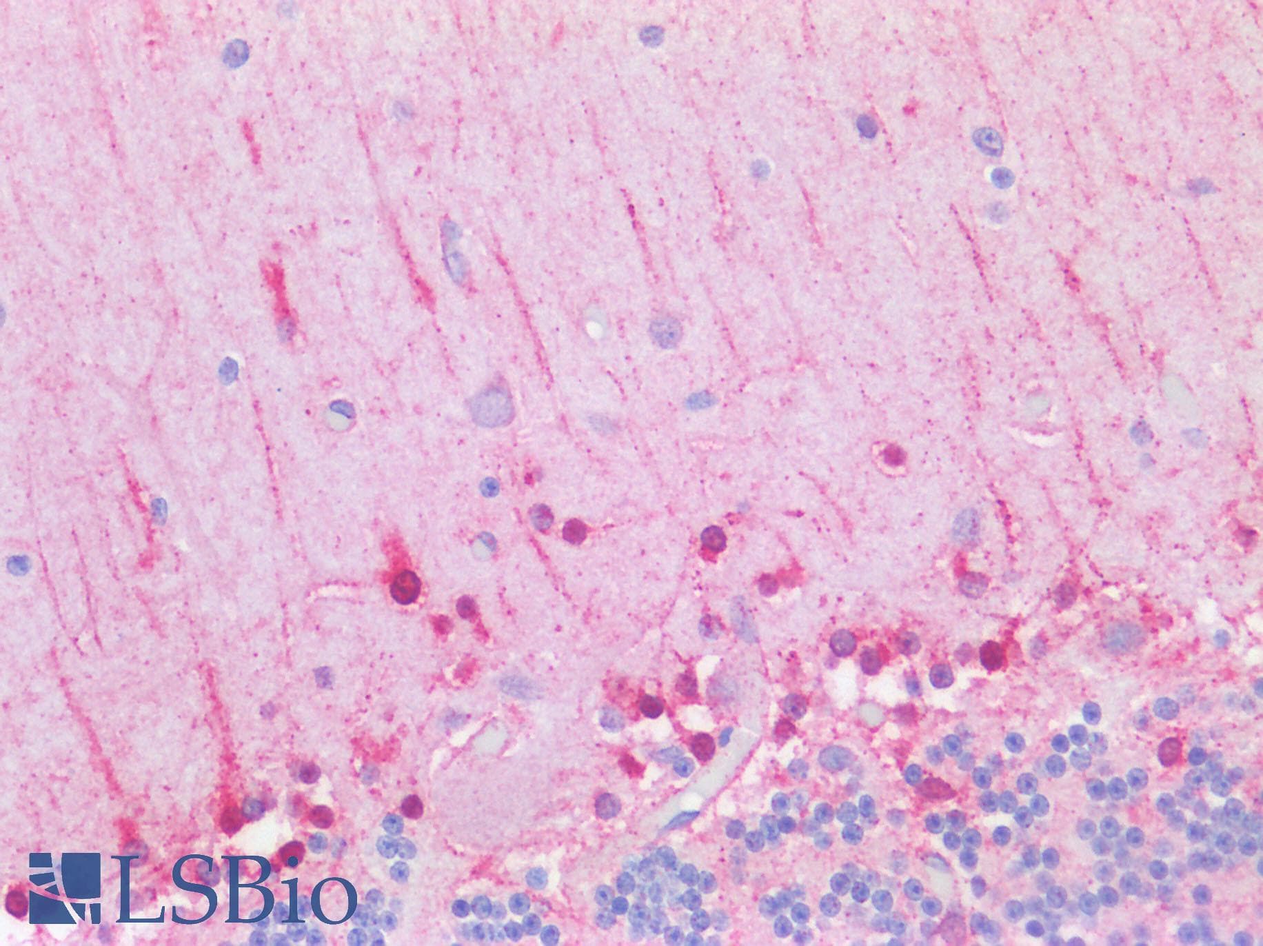 Polyclonal Rabbit anti-Human RALGAPB / KIAA1219 Antibody (aa1025-1075, IHC, WB)