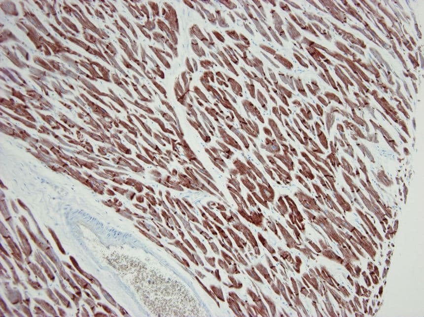 ACTC1 / Alpha Cardiac Actin Antibody (clone 22D3)