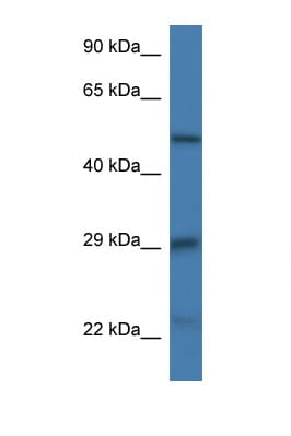GFAP Antibody (aa49-98)