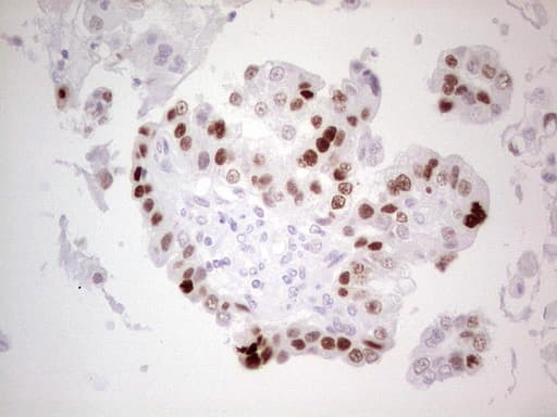 TP53 / p53 Antibody (clone OTI5B1)