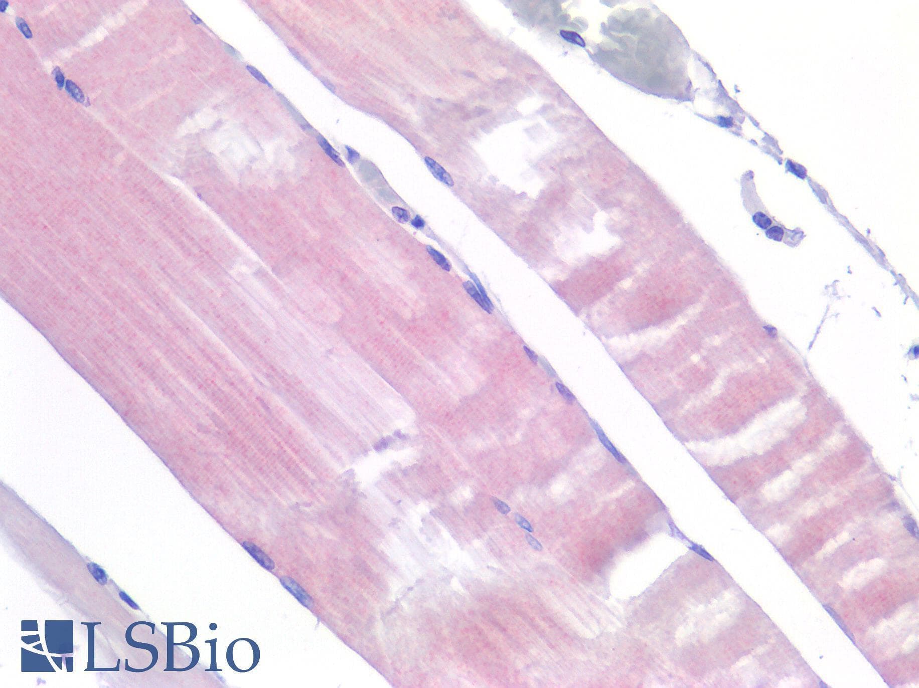 IHC-plus™ Polyclonal Rabbit anti-Human IL6R / IL6 Receptor Antibody (IHC)