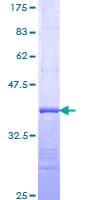 Human HBB / Hemoglobin Beta Protein (Recombinant GST, N-terminus)