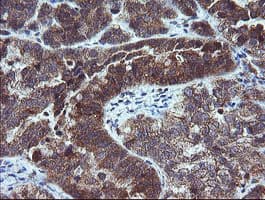 MMACHC Antibody (clone OTI1A4)