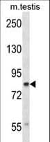 Polyclonal Rabbit anti-Human Cullin 4A / CUL4A Antibody (aa31-60, WB)