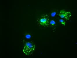 NOG / Noggin Antibody (clone OTI4C12)
