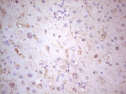 MTOR Antibody (aa1766-2144, clone OTI5B3)