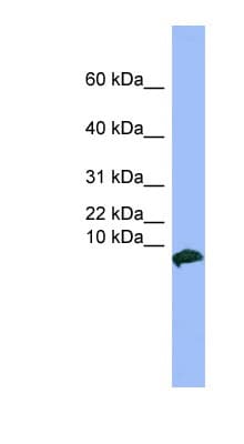 Polyclonal Rabbit anti-Human VIP Antibody (C-Terminus, WB)