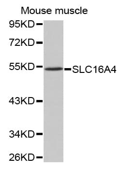 Polyclonal Rabbit anti-Human SLC16A4 Antibody (IHC, WB)