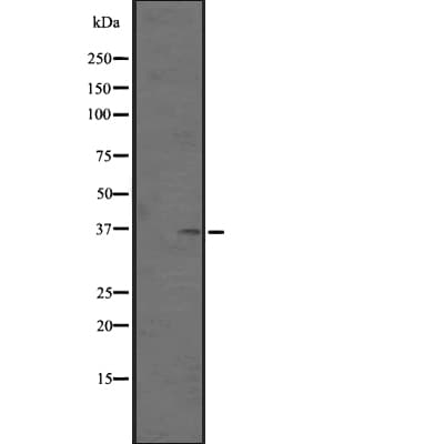 OR51M1 Antibody