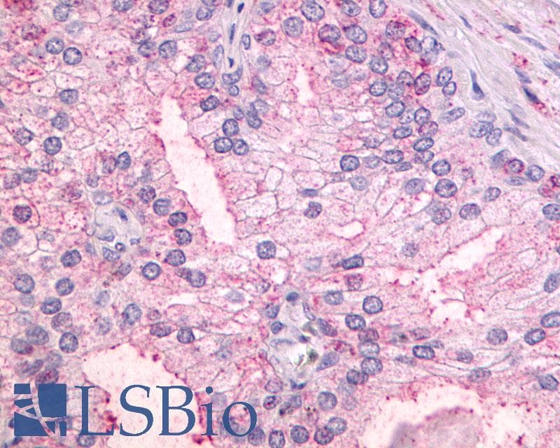 PathPlus™ GPR55 Antibody (C-Terminus)