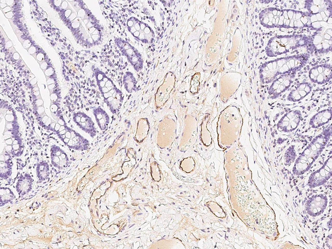 APCS / Serum Amyloid P / SAP Antibody (Preservative Free)