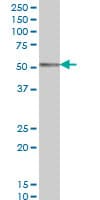 PathPlus™ Monoclonal Mouse anti-Human CORO1A / Coronin 1a Antibody (clone 4G10, IHC, WB)