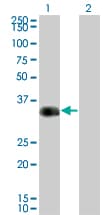 CRD / CRX Antibody (clone F6-C2)