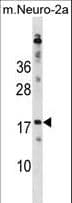 IHC-plus™ RPL30 / Ribosomal Protein L30 Antibody (aa1-30)