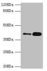 Polyclonal Rabbit anti-Human GDAP1 Antibody (IHC, WB)