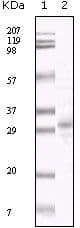 Monoclonal Mouse anti-Virus HHV-8 ORF26 Antibody (clone 2F6B8, WB)