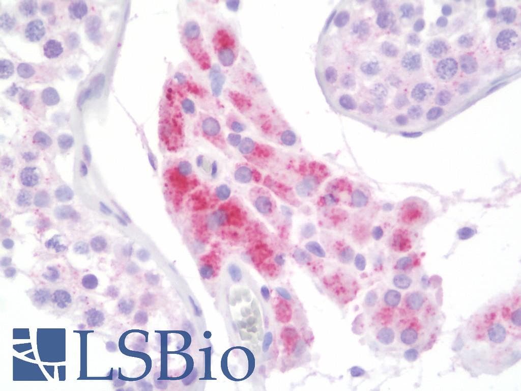 IHC-plus™ GLB1 / Beta-Galactosidase Antibody (clone 5H2)