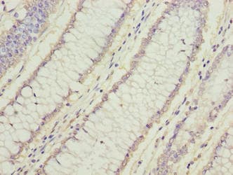 Polyclonal Rabbit anti-Human FAM78A Antibody (IHC, WB)