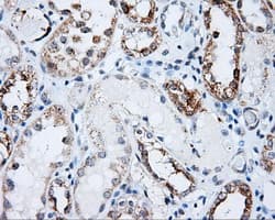 Monoclonal Mouse anti-Human LIPG / Endothelial Lipase Antibody (clone OTI8E4, IHC, IF, WB)
