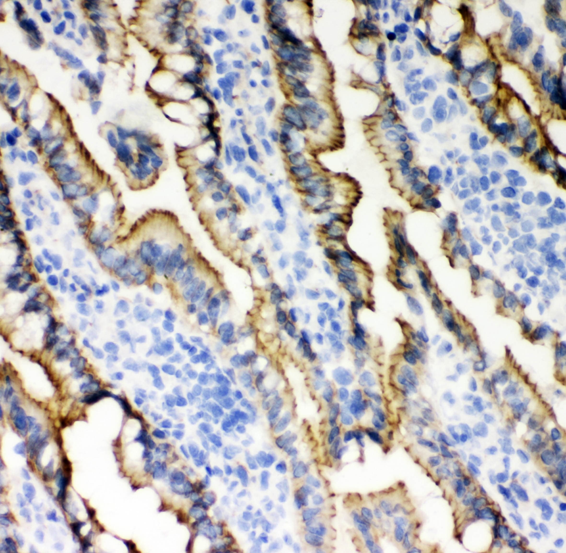 CDH1 / E Cadherin Antibody (aa286-703)