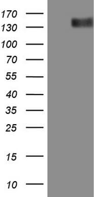 ERBB3 / HER3 Antibody (clone OTI1A5)