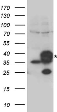 CYB5R3 / B5R Antibody