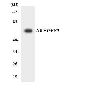 IHC-plus™ ARHGEF5 Antibody (aa1251-1300)