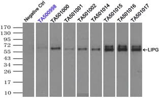 LIPG / Endothelial Lipase Antibody (clone OTI9C5)