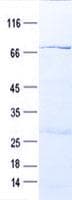 Human Gasdermin D / GSDMD Protein (Recombinant GST, N-terminus + His, C-terminus)