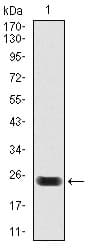 TNNT2 / CTNT Antibody (clone 1G1)