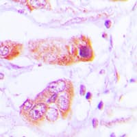 Polyclonal Rabbit anti-Human BAIAP2L2 Antibody (Internal, IHC, WB)