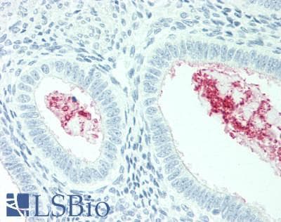 IHC-plus™ SLC34A2 / NaPi-2b Antibody (C-Terminus)