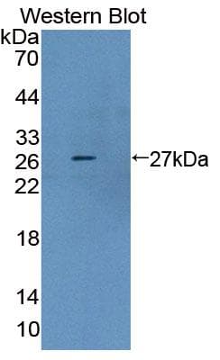 Polyclonal Rabbit anti-Human AUP1 Antibody (aa201-410, WB)