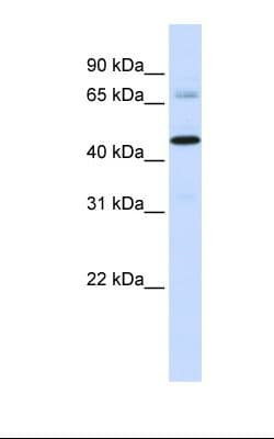 Polyclonal Rabbit anti-Human SFXN4 Antibody (C-Terminus, WB)