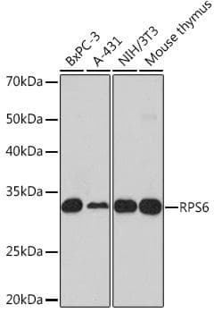 RPS6 / Ribosomal Protein S6 Antibody