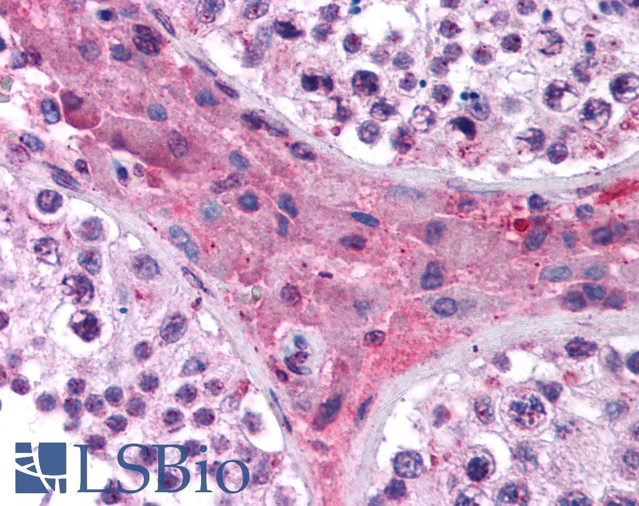 NR1H4 / FXR Antibody (aa194-243)
