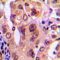 Polyclonal Rabbit anti-Human NPM1 / NPM / Nucleophosmin Antibody (N-Terminus, IHC, WB)