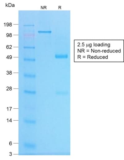 Recombinant Monoclonal Rabbit anti-Human CHGA / Chromogranin A Antibody (clone CHGA/1773R, Azide-free,Carrier-free, IHC)